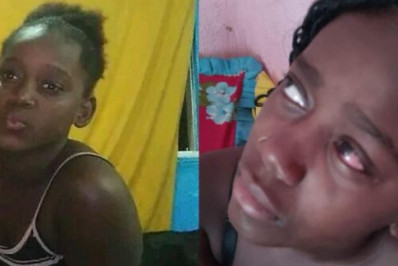 Demora de quatro anos para cirurgia ameaça visão de adolescente de Cabo Frio