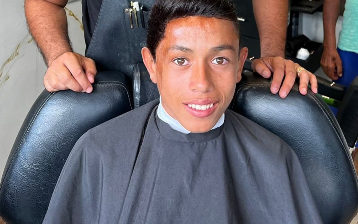 Ryan Amorim de Souza, de 15 anos, ganhou uma prótese capilar após ter 90% do crânio queimado - Divulgação