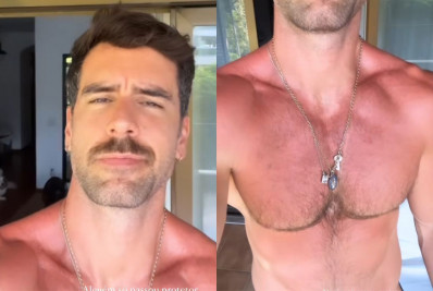 Marcos Pitombo dispensa protetor solar e acaba se bronzeando demais: ‘1º dia de verão