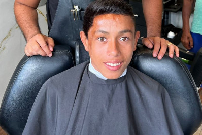 Após ter 90% do crânio queimado quando era bebê, menino ganha prótese capilar: 'Mudou minha vida'