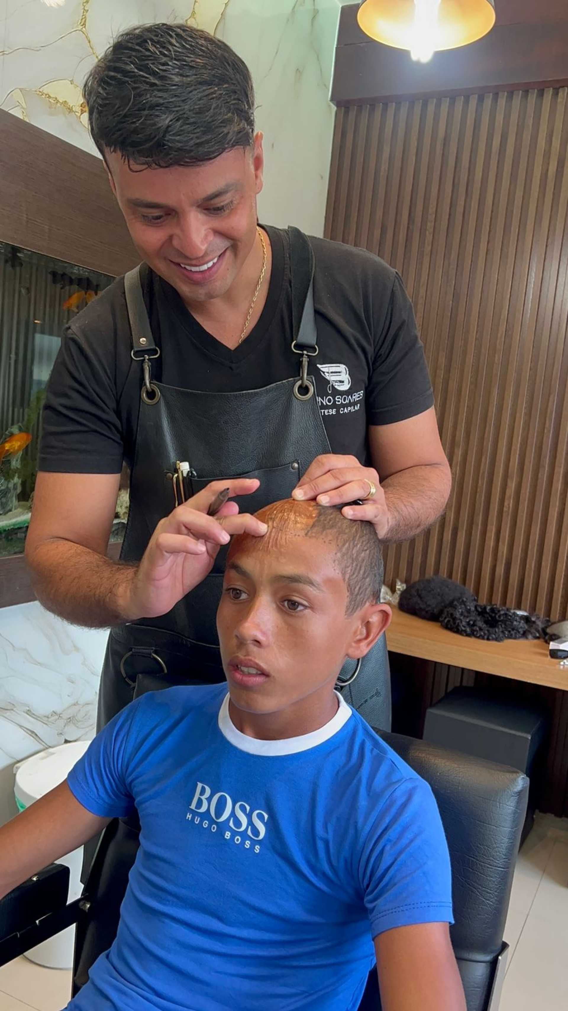 Ryan Amorim de Souza, de 15 anos, ganhou uma prótese capilar após ter 90% do crânio queimado