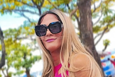 'Recuperação plena', diz paciente da primeira cirurgia de troca de sexo realizada pelo SUS