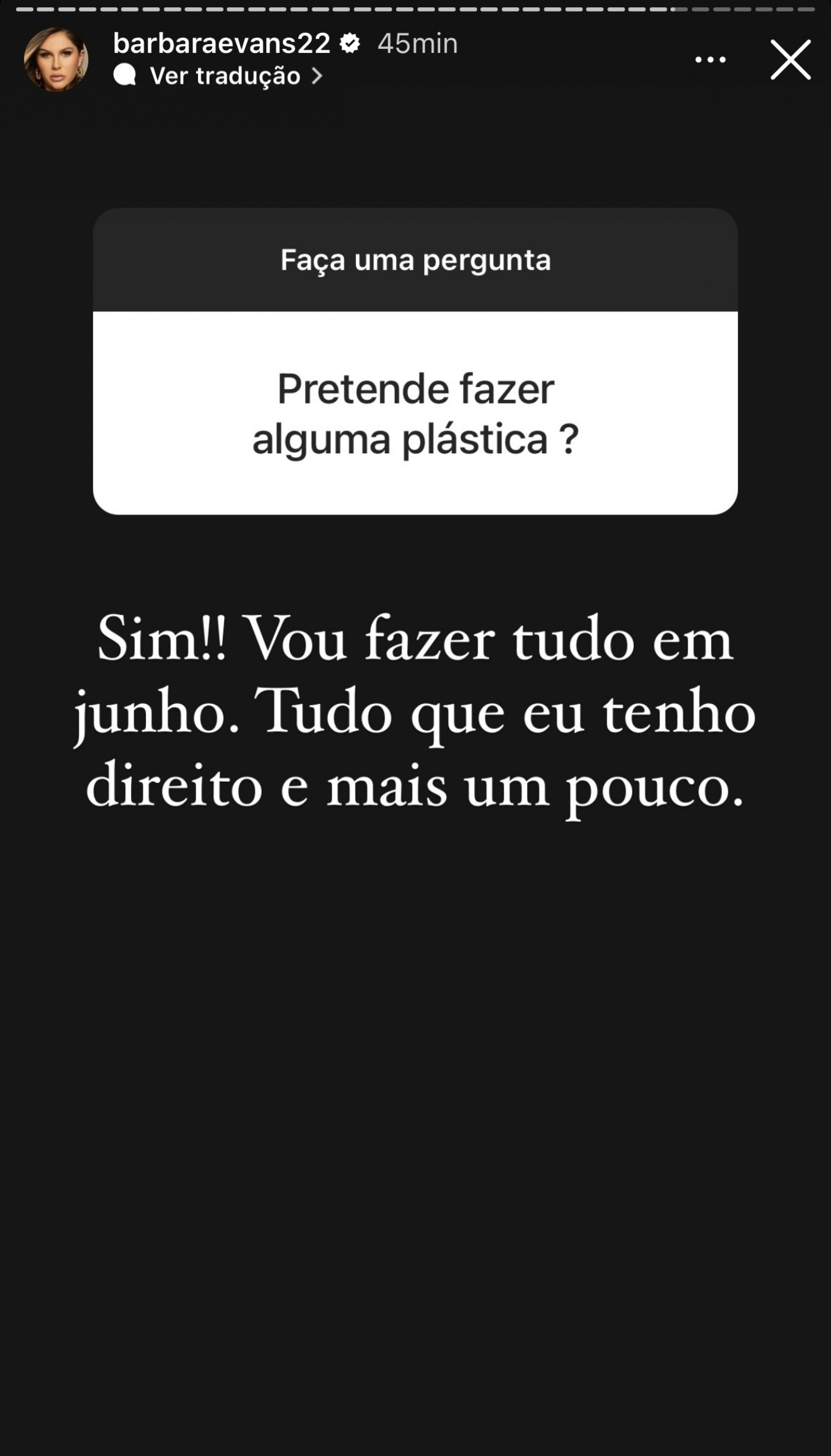 Bárbara Evans revela que vai realizar cirurgias plásticas - Reprodução