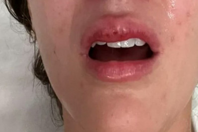 Casal é agredido e assaltado na Praia da Barra da Tijuca