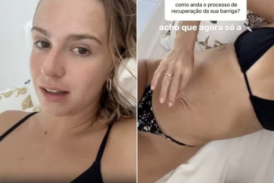 Isabella Scherer fala sobre recuperação da barriga após ter gêmeos: 'Só com cirurgia'