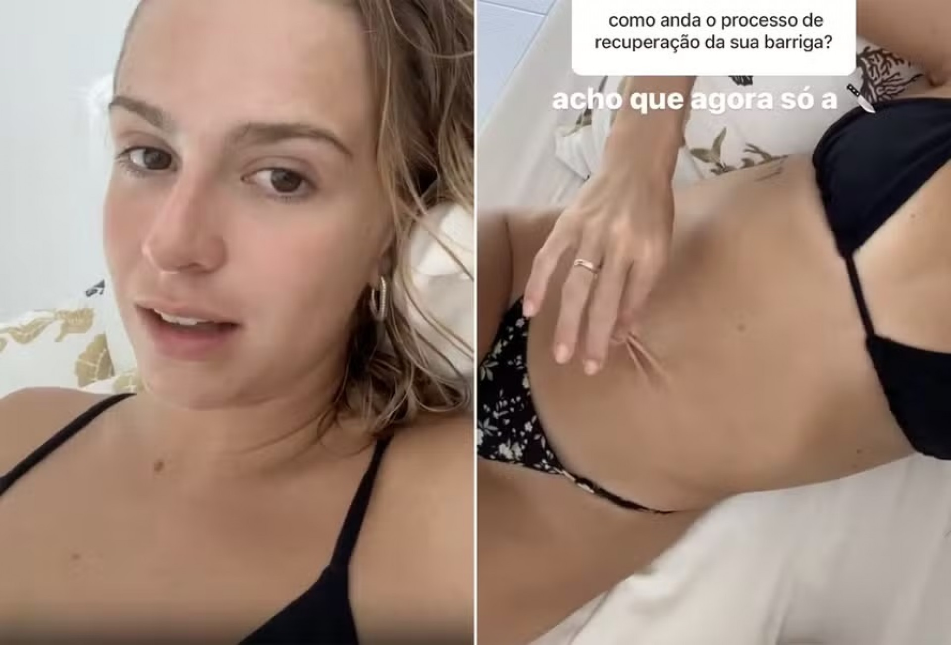 Isabella Scherer Fala Sobre Recupera O Da Barriga Ap S Ter G Meos S Com Cirurgia