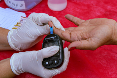 Queimados oferta serviços de saúde 