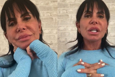 Gretchen lamenta críticas por procedimento em região íntima: 'É minha'