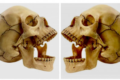 Desvendado o mistério dos dois crânios humanos