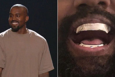 Kanye West coloca prótese dentária de titânio avaliada em R$ 4 milhões