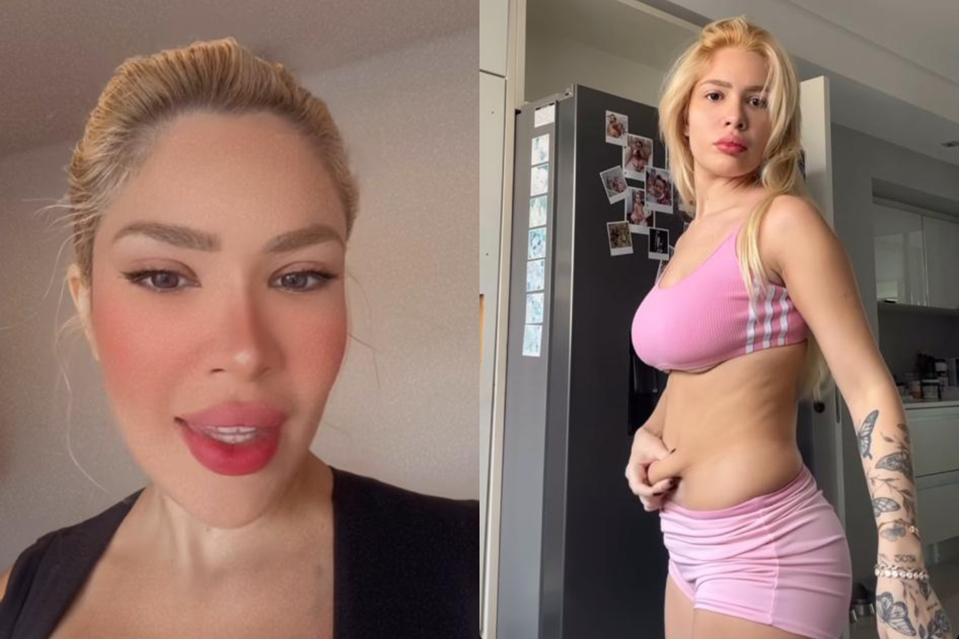 Karoline Lima revela ter feito novas cirurgias plásticas - Reprodução / Instagram 