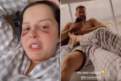Maraisa aparece de rosto roxo e mostra cuidados do noivo após acidente: 'Meu enfermeiro'