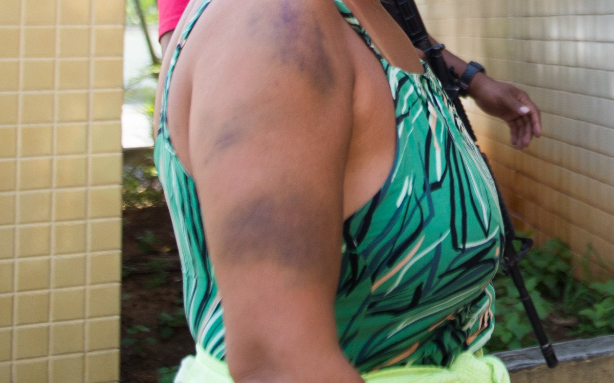 Adriana Freitas Ribeiro, fisioterapeuta agredida pelo ex marido, retorna a delegacia de Vicente de Carvalho. Fotos: Armando Paiva/Ag&ecirc;ncia O Dia