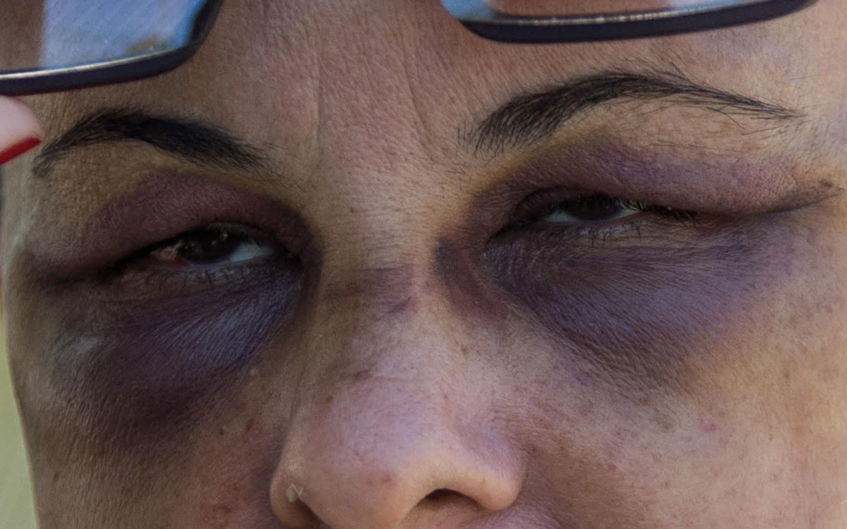 Adriana Freitas Ribeiro, fisioterapeuta agredida pelo ex marido, retina a delegacia de Vicente de Carvalho. 