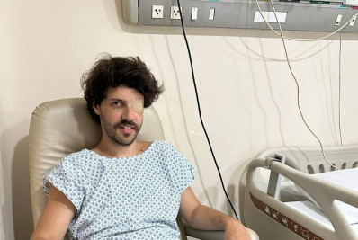 Diogo Defante faz cirurgia para corrigir olho caído: 'Fim de uma era'