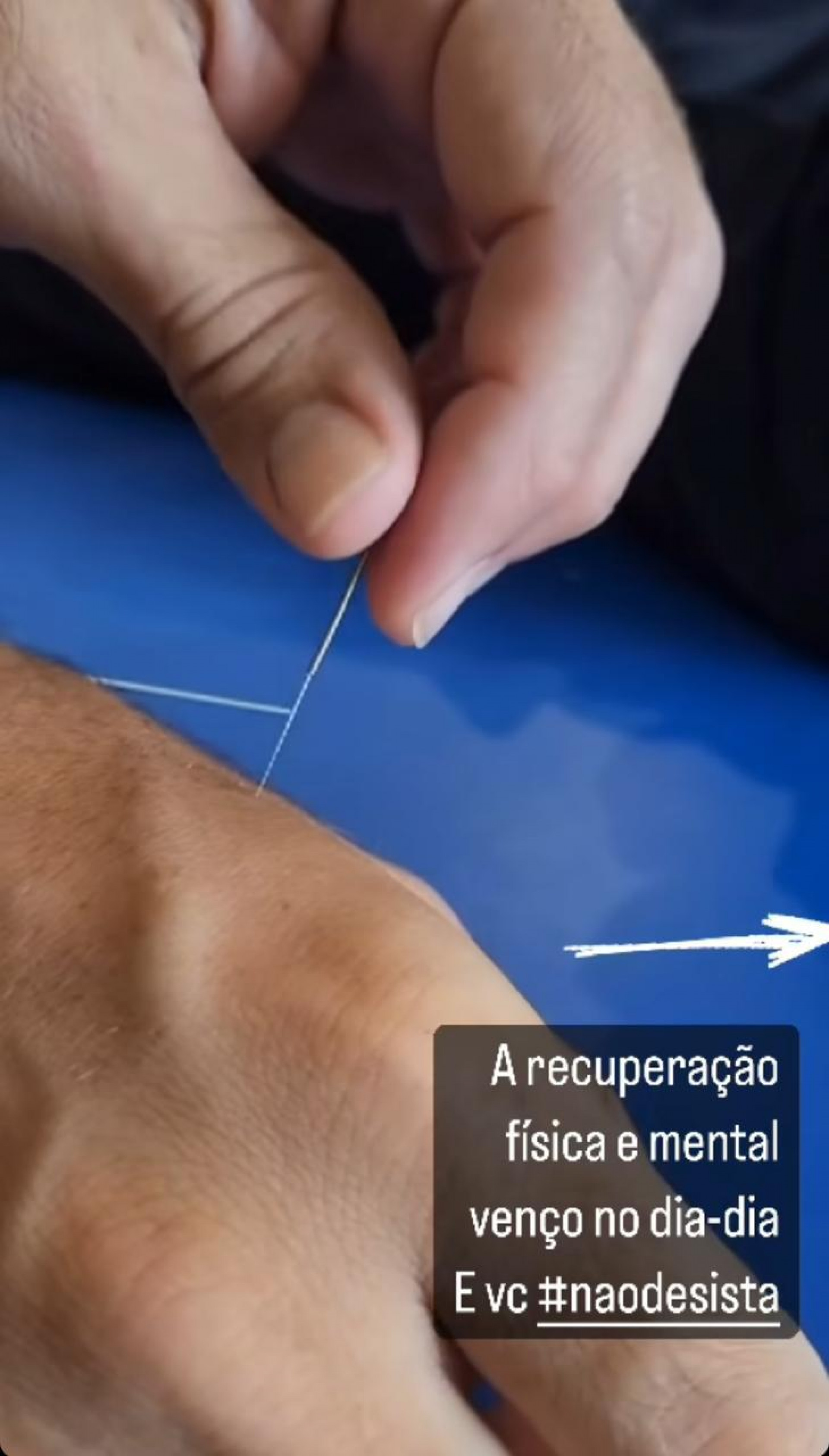 Kayky Brito na fisioterapia - Reprodu&ccedil;&atilde;o/Instagram