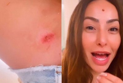 Sabrina Sato mostra machucados após desfiles de Carnaval: 'Não consigo nem andar'