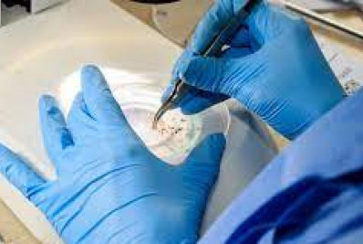 Brasil vai ampliar uso da bactéria wolbachia no combate à dengue