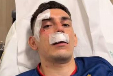 Vídeo! Jogadores do Fortaleza são hospitalizados após ataque a ônibus com bombas e pedras