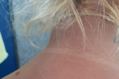 Lutador de jiu-jitsu é preso em flagrante por agredir companheira em Nova Iguaçu