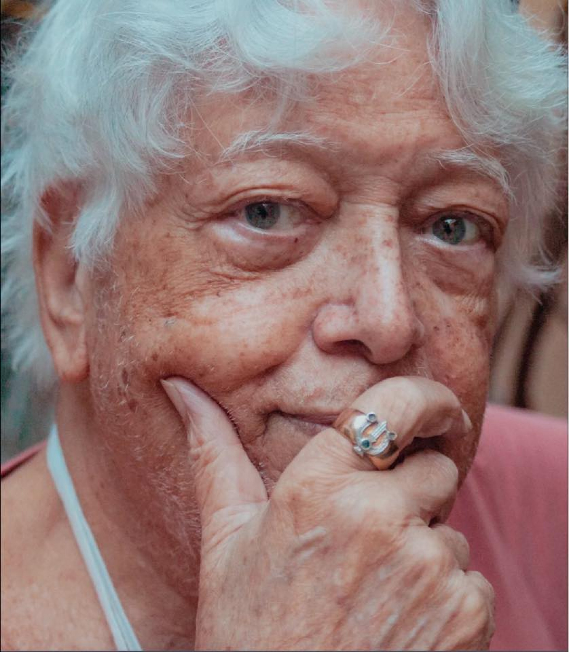 Hermínio Bello de Carvalho desabafa sobre acidente sofrido em calçada na Zona Sul do Rio - Reprodução / Facebook