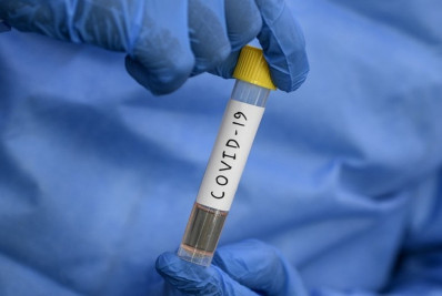 Estudo do governo irá avaliar sequelas da covid-19 na população brasileira