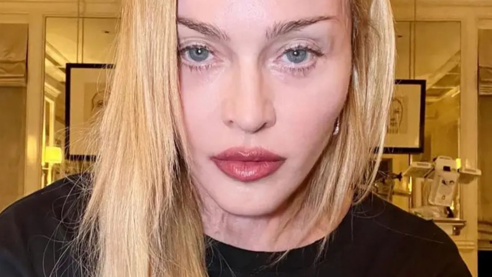 Fã cadeirante que levou bronca de Madonna se pronuncia após gafe - Reprodução/Instagram