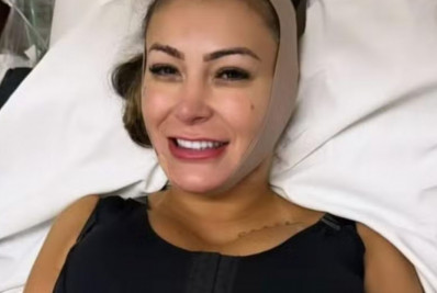 Andressa Urach desabafa sobre inchaço após cirurgias: 'Parece um baiacu'