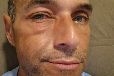 Com conjuntivite, Fabricio Battaglini ficará afastado do 'Mais Você'