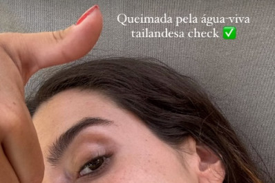 Giovanna Lancellotti é queimada por água-viva na Tailândia