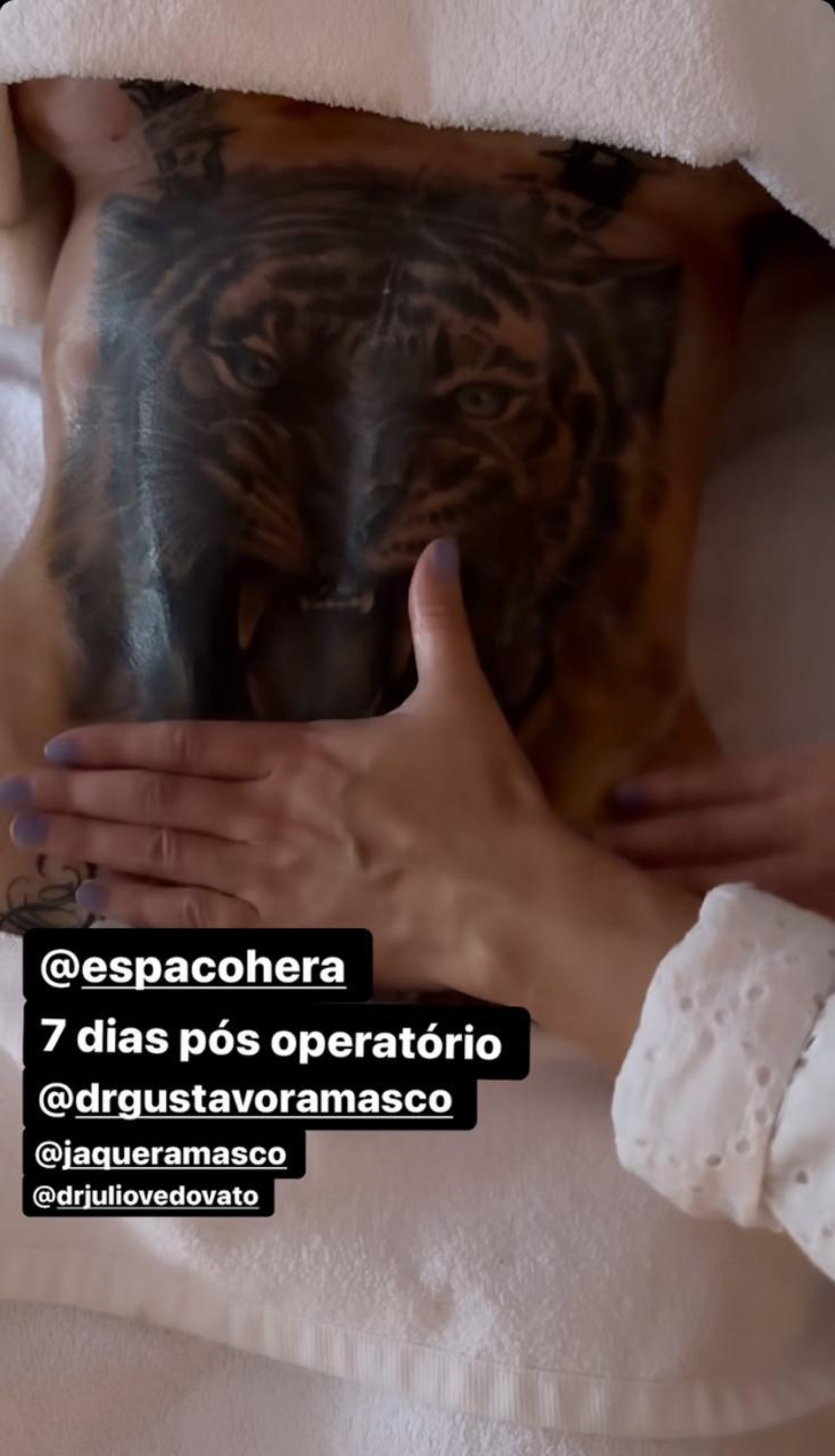Andressa Urach exibe cintura após cirurgia - Reprodução/Instagram