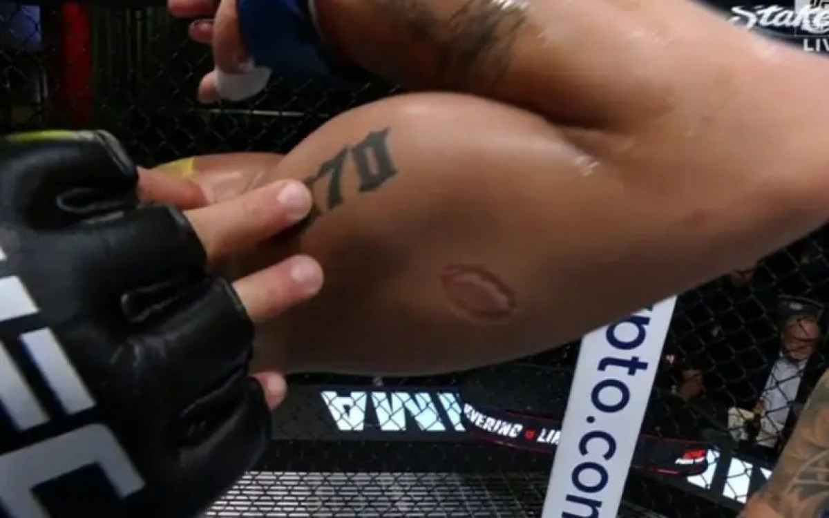 André Mascote teve o braço mordido por Igor Severino