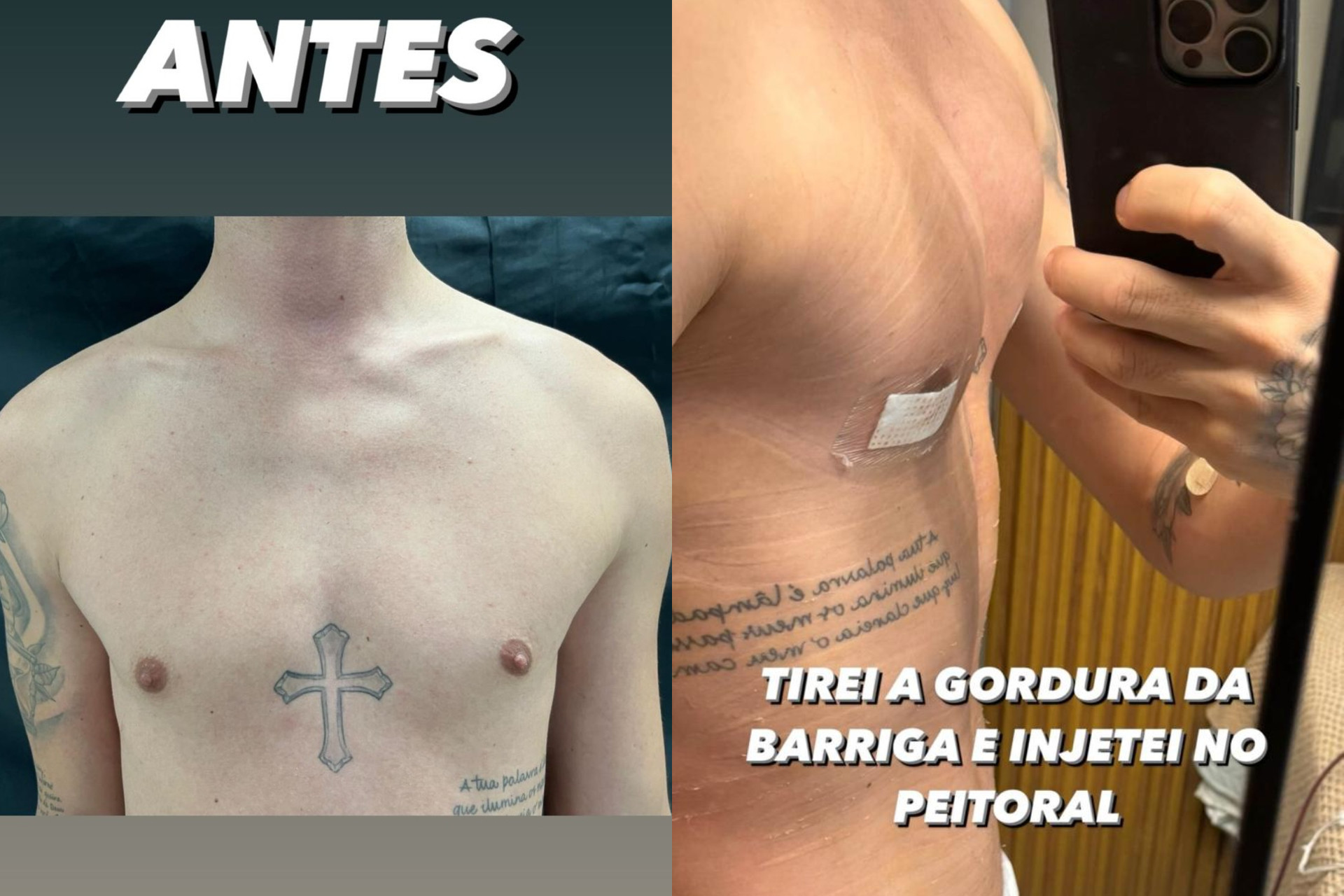 Antes e depois da lipoaspiração de Rico Melquiades  - Reprodução / Instagram 