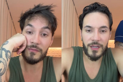 Eliezer revela que desfez harmonização facial: 'Tive distorção de imagem'