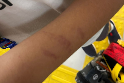 Polícia investiga agressão a criança autista dentro de escola particular no Recreio