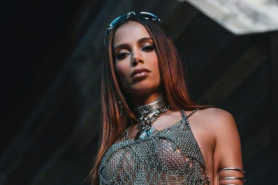 Anitta revela incômodo e planos de eliminar 'veia na testa' 