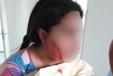 Conheça o misterioso caso da jovem que 'chora' sangue