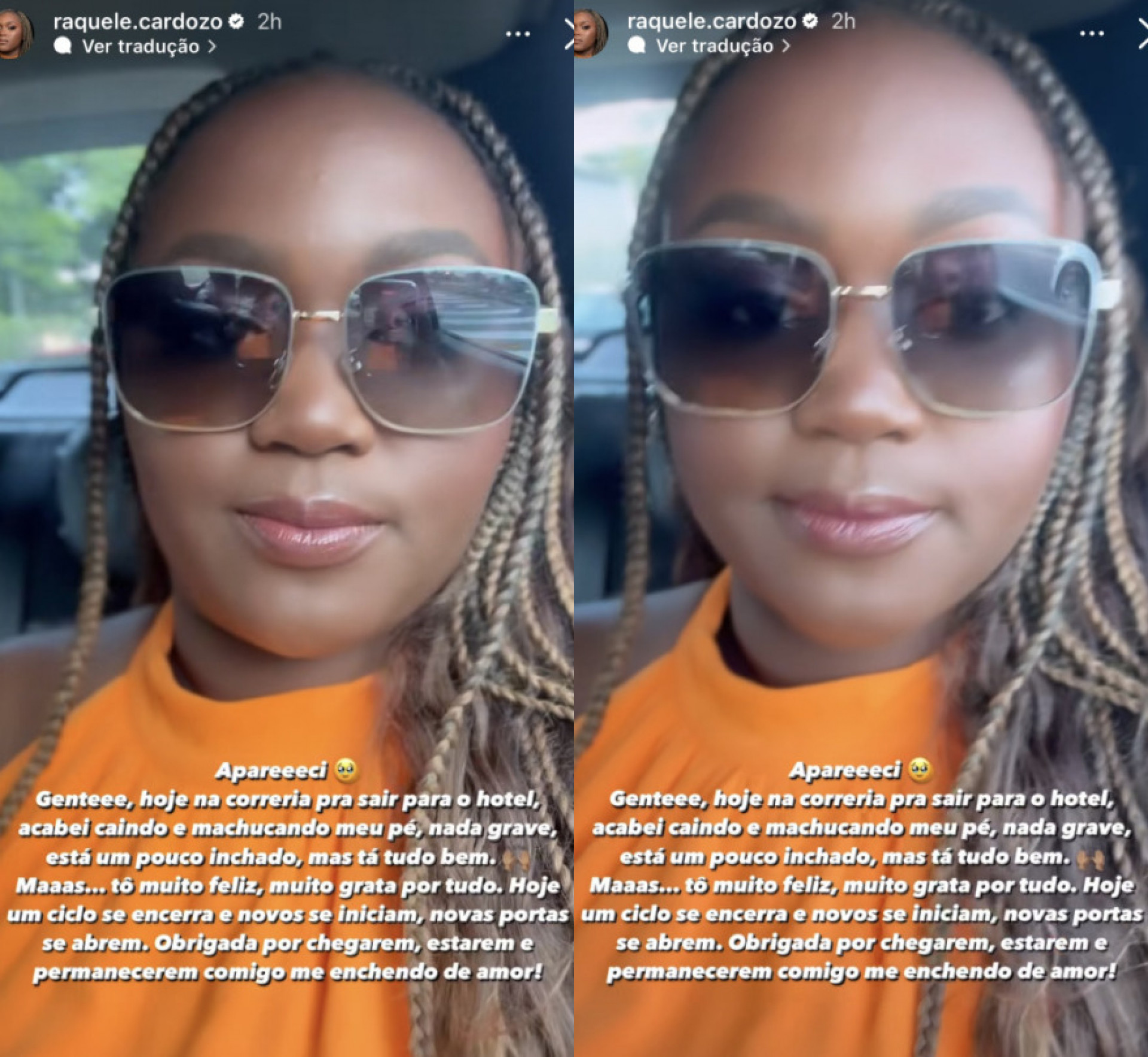 Raquele conta que machucou o pé horas antes da final do 'BBB 24' - Reprodução