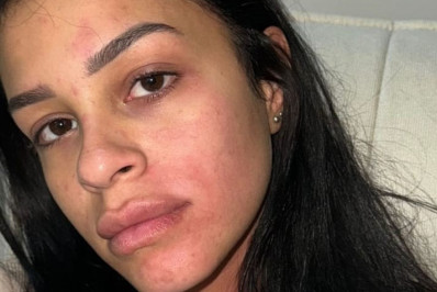 Botafogo afasta Kauê por acusação de agressão a ex-namorada, que vai à polícia