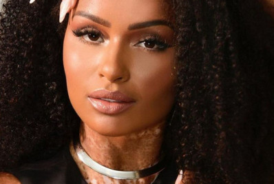 Natália Deodato relembra vazamento de vídeo íntimo: 'Vergonha de sair na rua'