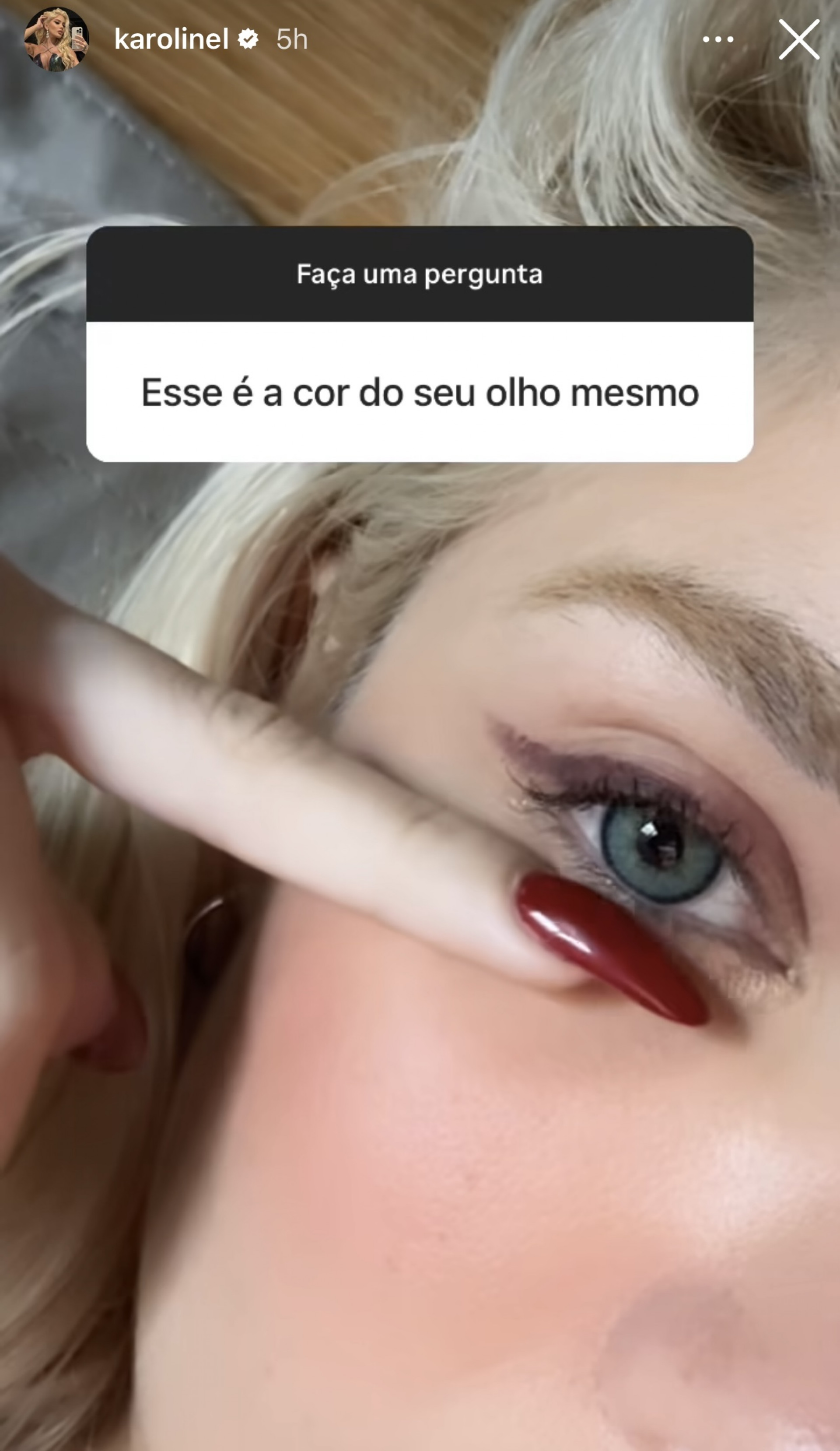 Karoline Lima impressiona ao mostrar foto antes de procedimentos estéticos - Reprodução