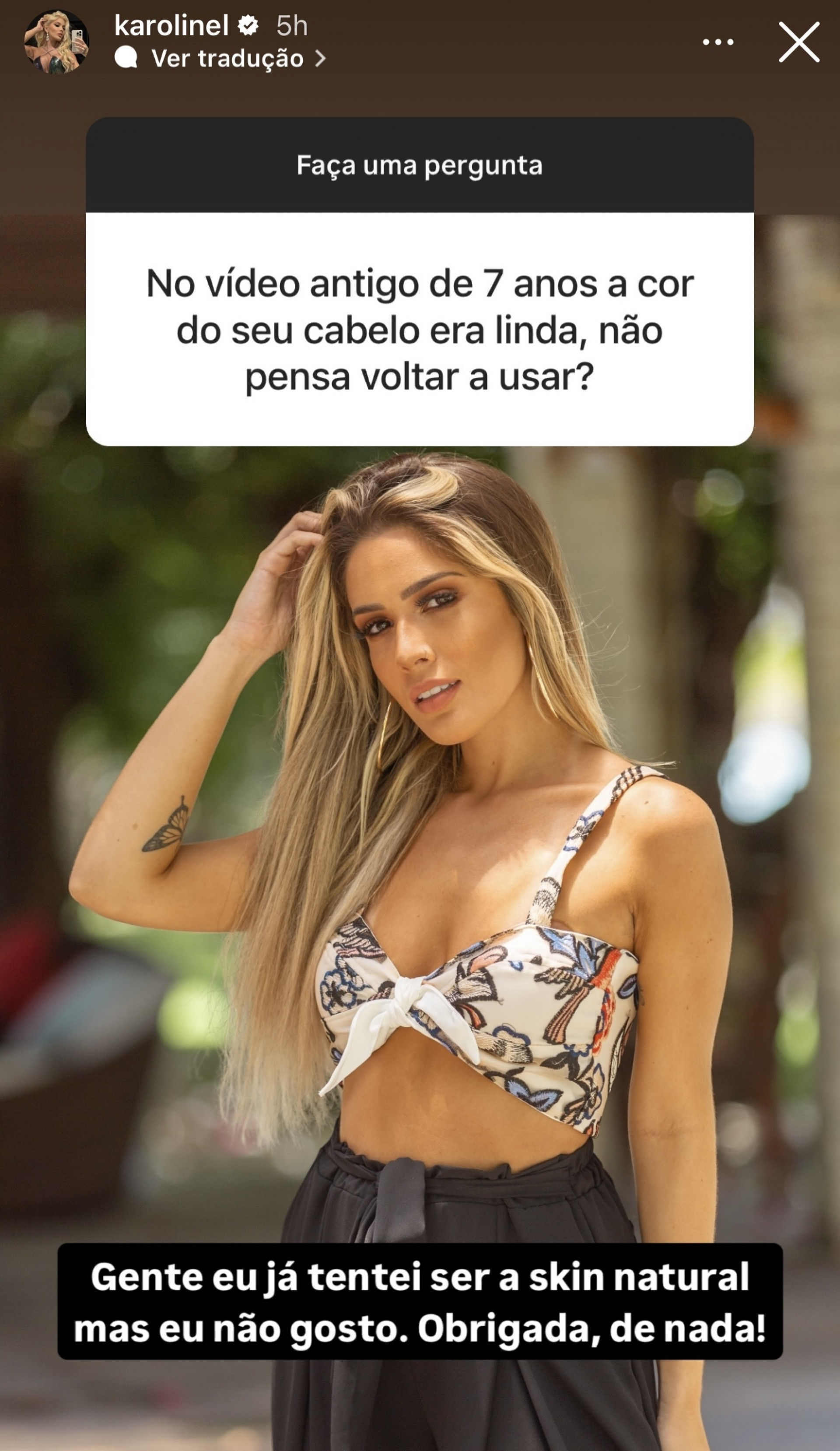 Karoline Lima impressiona ao mostrar foto antes de procedimentos estéticos - Reprodução