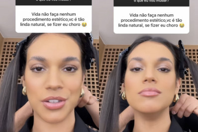 Alane revela se faria procedimentos estéticos: 'Fiquem tranquilos'