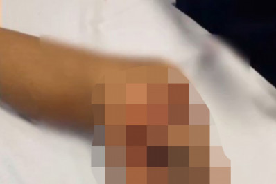 Adolescente é mordido por jacaré ao entrar em córrego para resgatar pipa na Zona Oeste