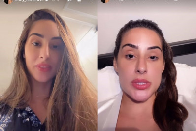 Deniziane mostra recuperação de cirurgia plástica: 'Não é fácil'