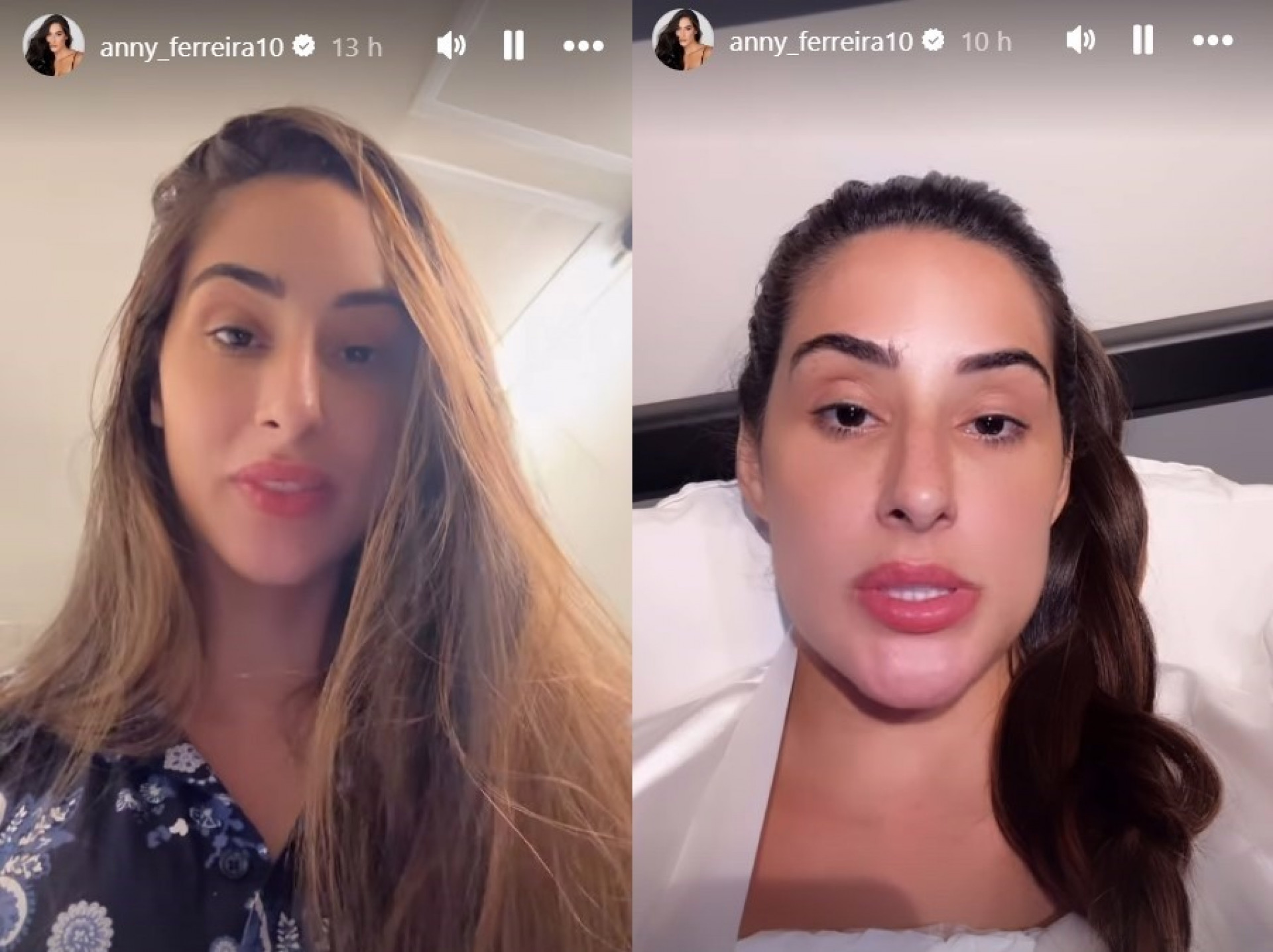 Ex-BBB Deniziane compartilha momentos da recuperação após cirurgia plástica - Reprodução / Instagram