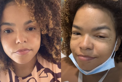 Jeniffer Nascimento diz que ainda não se recuperou totalmente de alergia