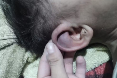 Avó suspeita de agredir bebê de 1 ano em Nova Iguaçu é indiciada por tortura