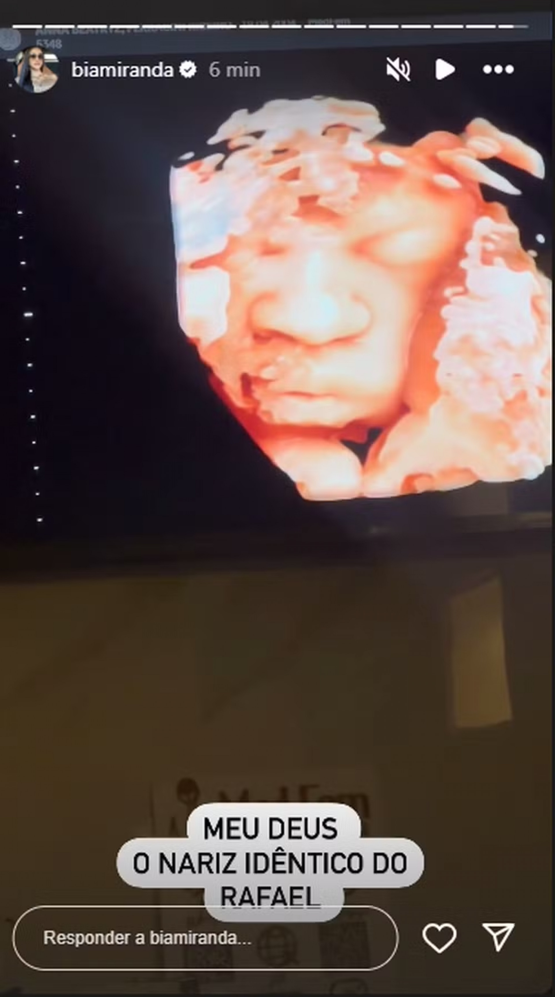 Stories de Bia Miranda - Reprodução / Redes Sociais