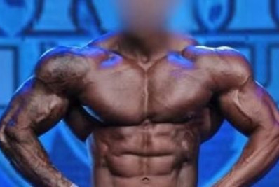 Fisiculturista é suspeito de agredir companheira e alegar 'queda' para justificar costelas quebradas